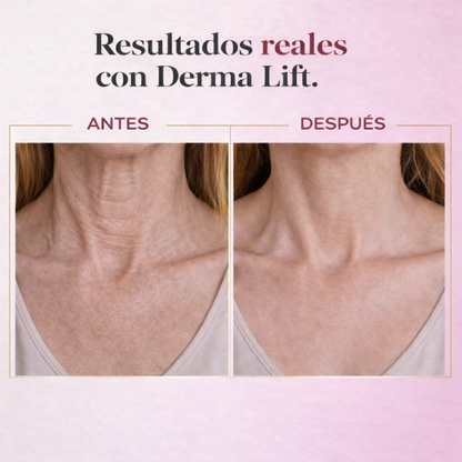 Dermalift™ | Tratamiento Reafirmante Intensivo Cuello y Busto
